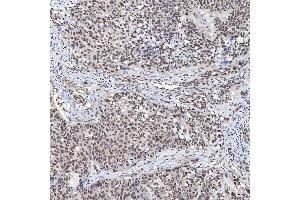 IHC analysis of U1A/SNRPA using anti-U1A/SNRPA antibody (ABIN7600891). (SNRPA1 抗体  (AA 25-218))