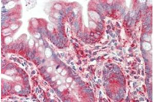 Human Small Intestine: Formalin-Fixed, Paraffin-Embedded (FFPE)