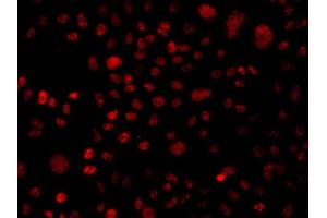 Immunofluorescence analysis of A549 cell using BAF250 antibody. (ARID1A 抗体)
