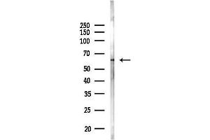 Western blot analysis of lysates from Mouse lung, using CES2 Antibody at 1/1000 dilution.