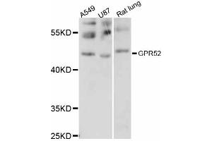 Western blot analysis of extracts of various cell lines, using GPR52 antibody (ABIN6292090) at 1:1000 dilution.