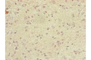 Immunohistochemistry (IHC) image for anti-Dynein, Cytoplasmic 2, Light Intermediate Chain 1 (DYNC2LI1) (AA 1-352) antibody (ABIN7149326)
