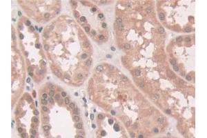 Detection of ATP7b in Human Kidney Tissue using Polyclonal Antibody to ATPase, Cu++ Transporting Beta Polypeptide (ATP7b)