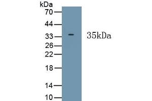 Detection of Recombinant HPS6, Human using Polyclonal Antibody to Hermansky Pudlak Syndrome Protein 6 (HPS6) (HPS6 抗体  (AA 500-775))