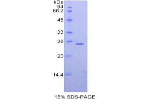 SDS-PAGE analysis of Mouse Thyroid Peroxidase Protein. (Thyroperoxidase 蛋白)