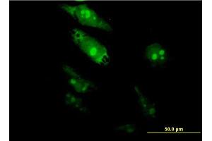 Immunofluorescence of monoclonal antibody to TGIF2 on HeLa cell. (TGIF2 抗体  (AA 131-236))