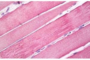 Image no. 1 for anti-Myosin X (MYO10) (Internal Region) antibody (ABIN1495955) (Myosin X 抗体  (Internal Region))