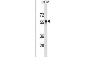 I5 Antibody (C-term) 18825b western blot analysis in CEM cell line lysates (35 μg/lane). (Apoptosis Inhibitor 5 抗体  (C-Term))