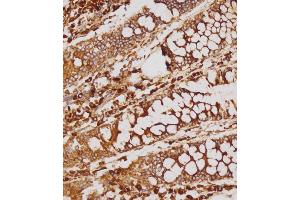 Immunohistochemical analysis of (ABIN1539214 and ABIN2838155) on paraffin-embedded human colon tissue was performed on the Leica®BOND RXm. (GATSL2 抗体  (N-Term))