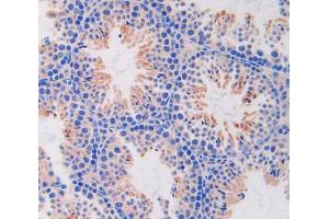IHC-P analysis of testis tissue, with DAB staining. (IL13 Receptor alpha 1 抗体  (AA 201-360))