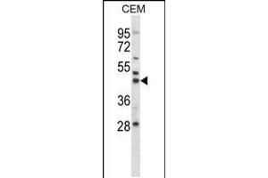 Western blot analysis in CEM cell line lysates (35ug/lane). (MEK2 抗体  (N-Term))
