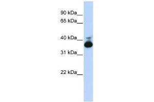 ALDOB antibody used at 1 ug/ml to detect target protein. (ALDOB 抗体  (Middle Region))