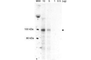 Western blot analysis of MLXIPL in liver nuclear extracts from well-fed rats. (MLXIPL 抗体  (AA 800-852))