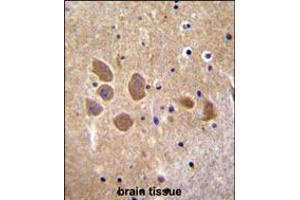 Immunohistochemistry (IHC) image for anti-Adaptor-Related Protein Complex 1, mu 1 Subunit (AP1M1) (AA 199-227) antibody (ABIN5535743)