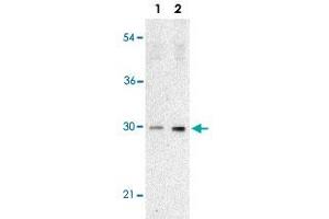 Western blot analysis of TP53INP1 expression in human lung tissue lysate with TP53INP1 polyclonal antibody  at 2 ug/mL in the absence (lane 1) or presence (lane 2) of blocking peptide. (TP53INP1 抗体  (C-Term))