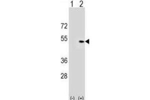 Western Blotting (WB) image for anti-Pleckstrin Homology Domain Containing, Family A (phosphoinositide Binding Specific) Member 1 (PLEKHA1) antibody (ABIN3000047) (PLEKHA1 抗体)