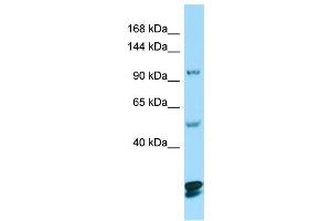 WB Suggested Anti-CTNND2 Antibody Titration: 1. (CTNND2 抗体  (C-Term))