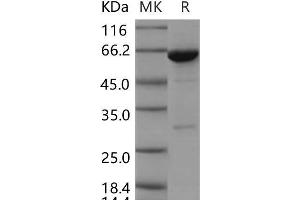 Western Blotting (WB) image for Protein-tyrosine Phosphatase 1C (PTPN6) (AA 207-597) (Active) protein (GST tag,His tag) (ABIN7320120)