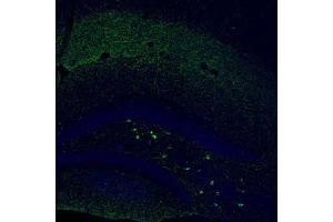 Immunofluorescent staining of mouse dentate gyrus shows moderate to strong positivity in a subset of neurons in the polymorph layer. (Somatostatin 抗体  (AA 25-107))