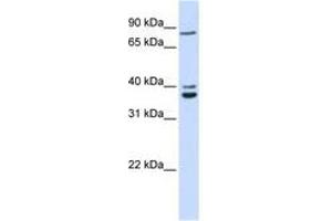 Image no. 1 for anti-Chromosome 18 Open Reading Frame 10 (C18orf10) (AA 108-157) antibody (ABIN6741301)