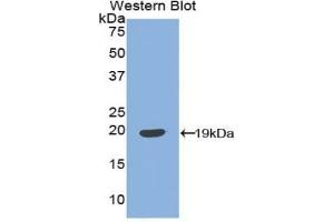 Detection of Recombinant IGFBP3, Bovine using Polyclonal Antibody to Insulin Like Growth Factor Binding Protein 3 (IGFBP3) (IGFBP3 抗体  (AA 106-241))