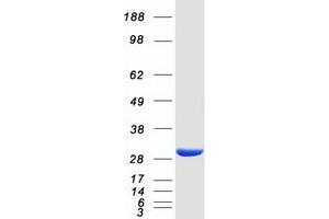 Western Blotting (WB) image for Haloacid Dehalogenase-Like Hydrolase Domain Containing 2 (HDHD2) protein (Myc-DYKDDDDK Tag) (ABIN2722548)
