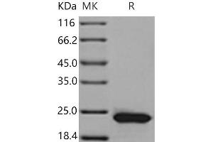 Retinol Binding Protein 4, Plasma (RBP4) (Active) protein (His tag)