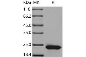 Western Blotting (WB) image for Retinol Binding Protein 4, Plasma (RBP4) (Active) protein (His tag) (ABIN7321242) (RBP4 Protein (His tag))