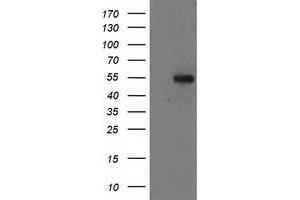 Western Blotting (WB) image for anti-Glucosidase, Beta, Acid 3 (Cytosolic) (GBA3) (AA 1-150), (AA 370-469) antibody (ABIN1490583) (GBA3 抗体  (AA 1-150, AA 370-469))
