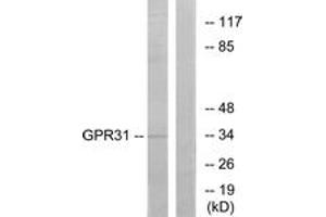 Western blot analysis of extracts from COLO cells, using GPR31 Antibody. (GPR31 抗体  (AA 181-230))