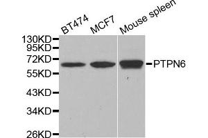 Western blot analysis of extracts of various cell lines, using PTPN6 antibody. (SHP1 抗体)