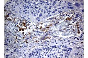 Image no. 1 for anti-Tyrosinase (TYR) (AA 19-320) antibody (ABIN1491083) (TYR 抗体  (AA 19-320))