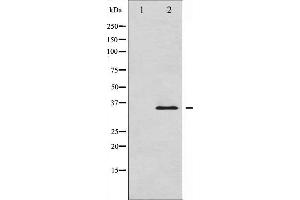 Western blot analysis of IkappaB-alpha expression in HuvEc whole cell lysates,The lane on the left is treated with the antigen-specific peptide. (NFKBIA 抗体  (C-Term))