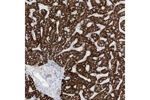 Immunohistochemical staining of human liver with PID1 polyclonal antibody  shows strong cytoplasmic positivity in hepatocytes.
