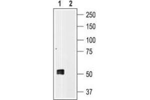 Western blot analysis of human platelet lysates: - 1. (P2RX1 抗体  (Intracellular))