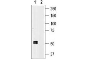 Western blot analysis of human platelet lysates: - 1. (P2RX1 抗体  (C-Term, Intracellular))