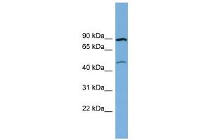WB Suggested Anti-TMEM48 Antibody Titration:  0. (TMEM48 抗体  (Middle Region))