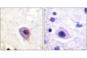Immunohistochemistry analysis of paraffin-embedded human brain, using DRP-2 (Phospho-Thr514) Antibody. (DRP2 抗体  (pThr514))
