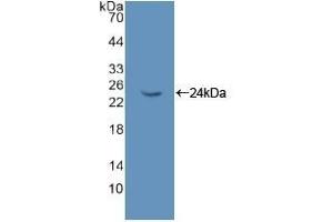 Detection of Recombinant NME6, Rat using Polyclonal Antibody to Non Metastatic Cells 6, Protein Expressed In (NME6) (Non Metastatic Cells 6, Protein Expressed In (AA 1-173) 抗体)