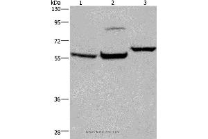 Western blot analysis of Mouse brain tissue, 231 and Hela cell, using ESR1 Polyclonal Antibody at dilution of 1:200 (Estrogen Receptor alpha 抗体)