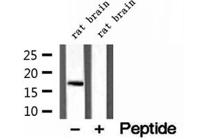 Western blot analysis of extracts of rat brain tissue, using CPLX1 antibody. (Complexin 1 抗体  (N-Term))