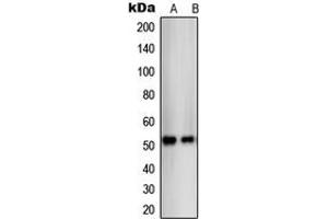 Western blot analysis of THRB expression in SKBR3 (A), C32 (B) whole cell lysates. (THRB 抗体  (N-Term))