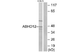 Western blot analysis of extracts from COLO cells, using ABHD12 antibody. (ABHD12 抗体)