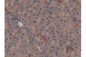 Used in DAB staining on fromalin fixed paraffin- embedded kidney tissue (SHBG 抗体  (AA 222-358))