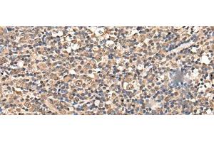 Immunohistochemistry of paraffin-embedded Human tonsil tissue using ZSCAN12 Polyclonal Antibody at dilution of 1:50(x200) (ZSCAN12 抗体)