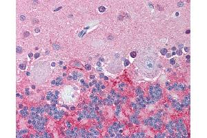 Anti-KCNJ6 / GIRK2 antibody IHC of human brain, cerebellum. (KCNJ6 抗体  (N-Term))