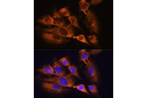 Immunofluorescence analysis of C6 cells using ACHE Rabbit pAb (ABIN3016742, ABIN3016743, ABIN3016744 and ABIN6219831) at dilution of 1:100. (Acetylcholinesterase 抗体  (AA 398-617))