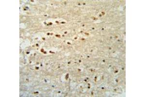 Immunohistochemistry analysis in human brain tissue (Formalin-fixed, Paraffin-embedded) using PTOV1  Antibody  (N-term), followed by peroxidase conjugated secondary antibody and DAB staining. (PTOV1 抗体  (N-Term))
