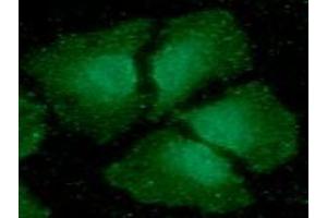 ICC/IF analysis of CIB1 in HeLa cells line, stained with DAPI (Blue) for nucleus staining and monoclonal anti-human CIB1 antibody (1:100) with goat anti-mouse IgG-Alexa fluor 488 conjugate (Green). (CIB1 抗体)