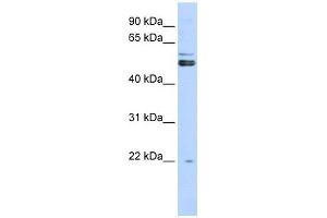 PRMT2 antibody used at 1 ug/ml to detect target protein. (PRMT2 抗体  (N-Term))